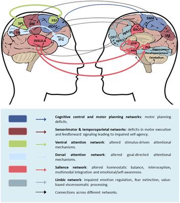 The neurobiology of functional neurological disorders characterised by impaired awareness